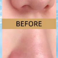 Blackhead Removal Nose Pore Strip